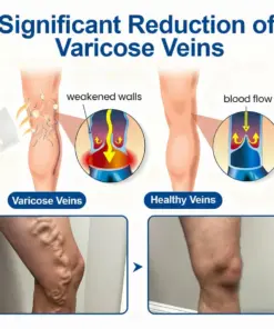 MHDLY® VeinEase Microneedle Care Patch